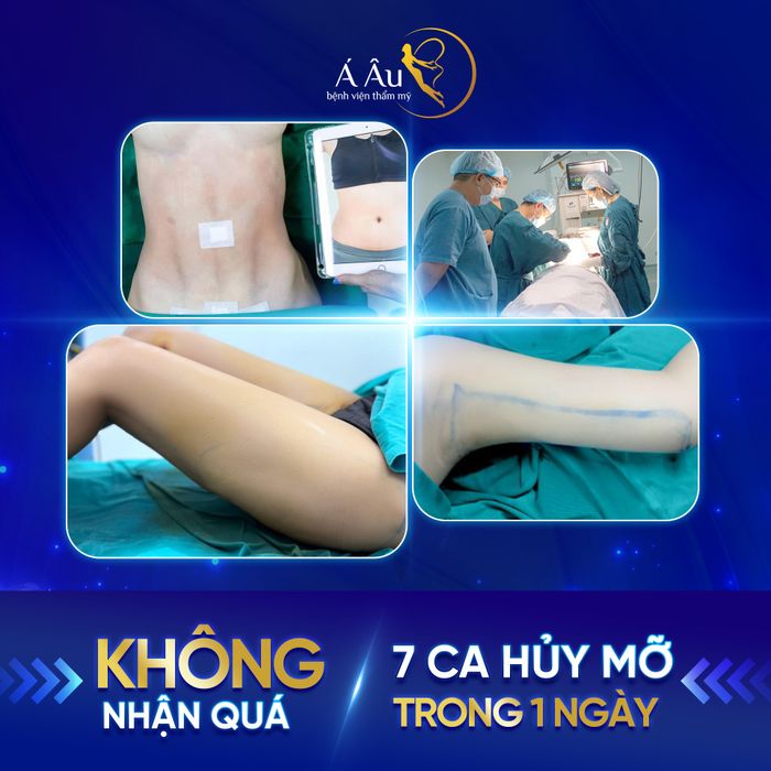 Ảnh 1 của Bệnh viện Thẩm mỹ Á Âu