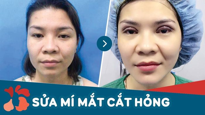 Hình ảnh Bệnh viện thẩm mỹ Kangnam 2