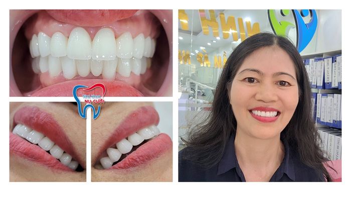 Phòng Khám Răng Nụ Cười hình 3