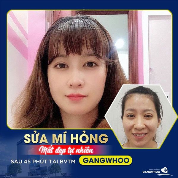 Bệnh viện thẩm mỹ Gangwhoo hình ảnh 1
