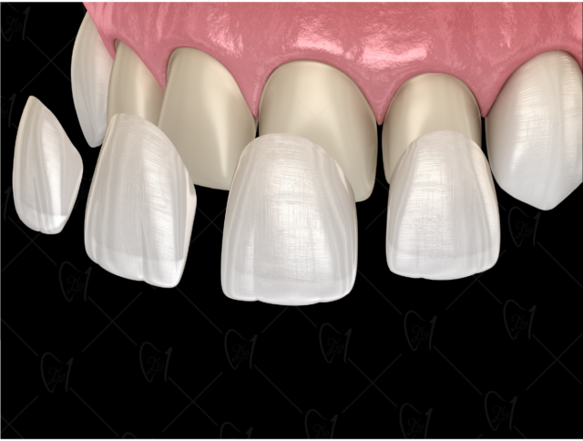 Nha khoa No1 Đà Nẵng hình ảnh 1