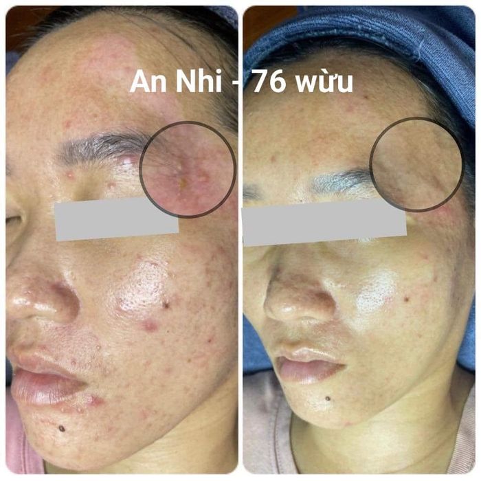 Hình ảnh 1 của AN NHI SPA