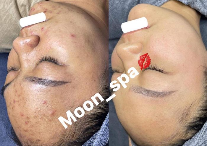Hình ảnh 2 của Moon Spa Beauty Center