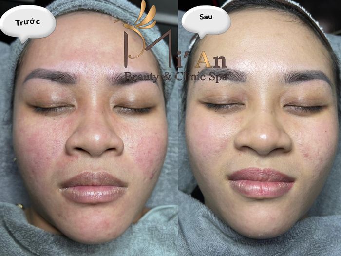 Hình ảnh Mi’An Beauty & Clinic Spa - 1