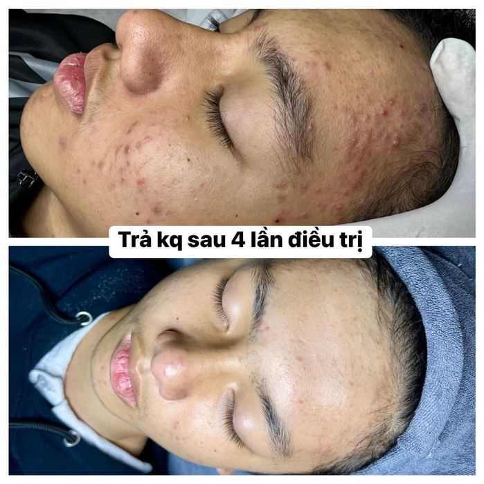 Hình ảnh 1 của Spa Sắc Việt