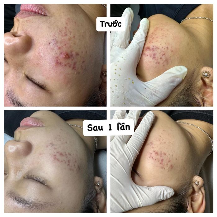 Hình ảnh 2 của Spa Sắc Việt