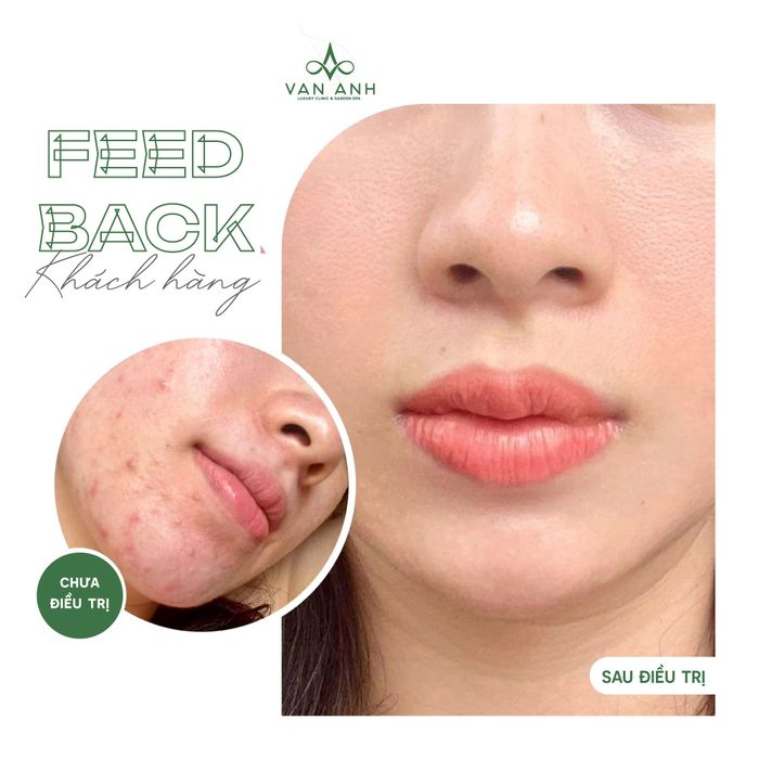 Hình ảnh 1 của Van Anh Luxury Clinic & Garden Spa
