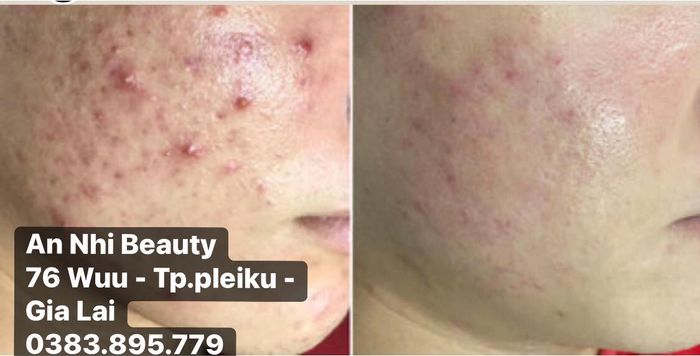Hình ảnh 2 của AN NHI SPA