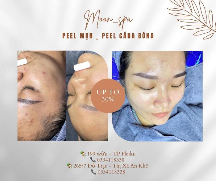 Hình ảnh 1 của Moon Spa Beauty Center