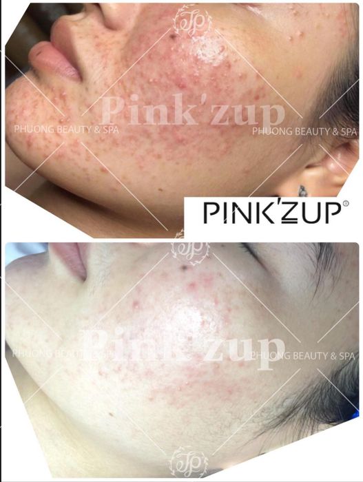 Ảnh của Clinic & Spa Ms Phượng