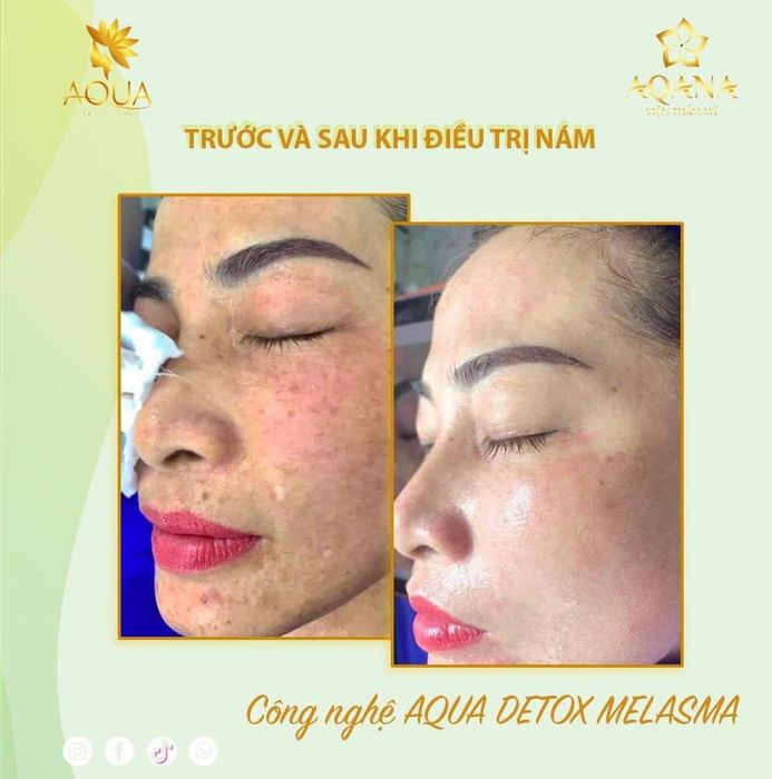 Hình ảnh Viện Thẩm Mỹ AQANA 2