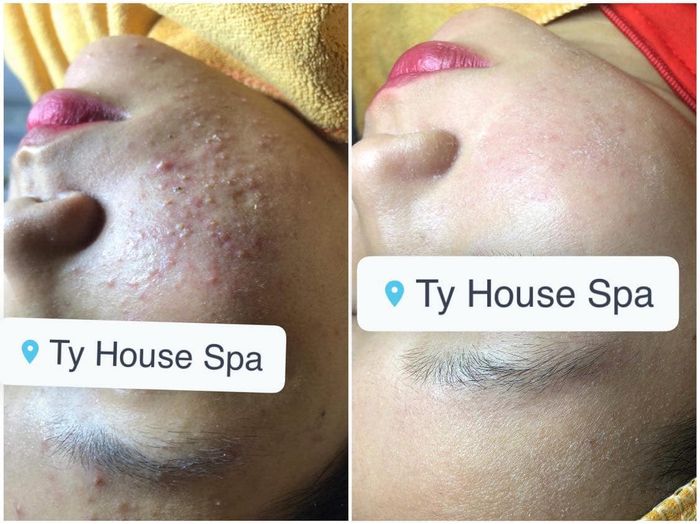 Hình ảnh 2 của Ty House Spa