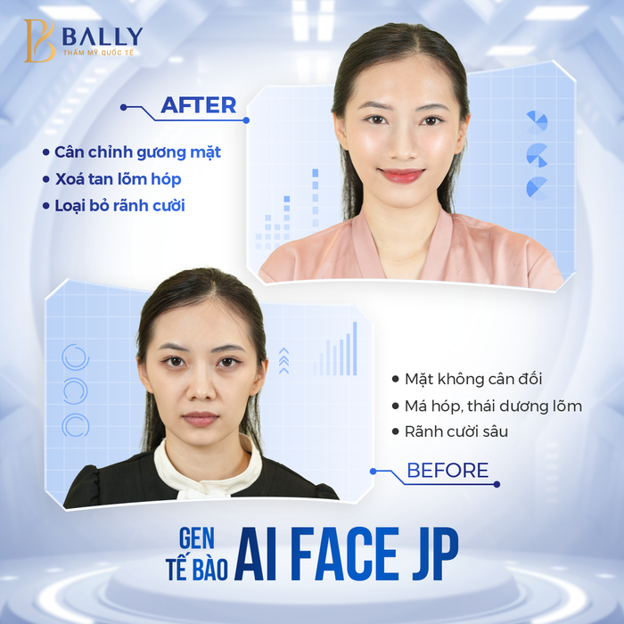 Hình ảnh Thẩm mỹ quốc tế Bally 2