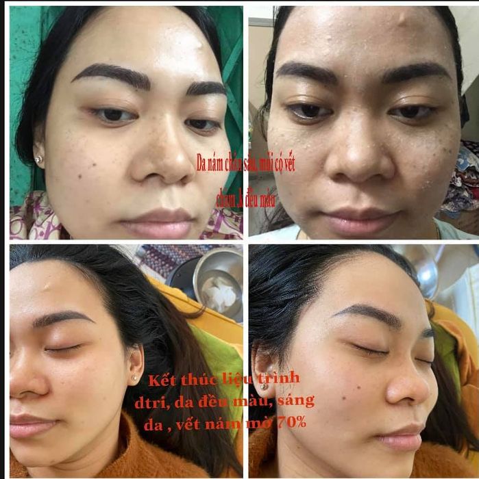 Hình ảnh Spa Hồ Hằng 1