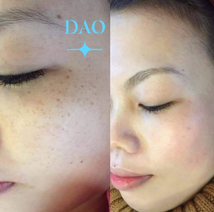 Hình ảnh Dao Spa 1
