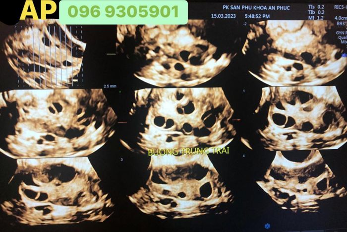 Hình ảnh 2 của Phòng khám sản phụ khoa - Hỗ trợ sinh sản An Phúc