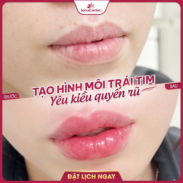 Bệnh Viện Thẩm Mỹ Quốc Tế SeoulCenter - Hình ảnh 2