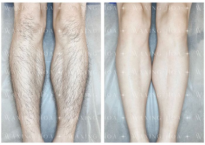 Ảnh 1 của Waxing Hoa