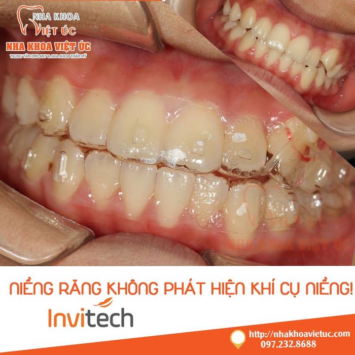 Nha khoa Việt Úc hình 2