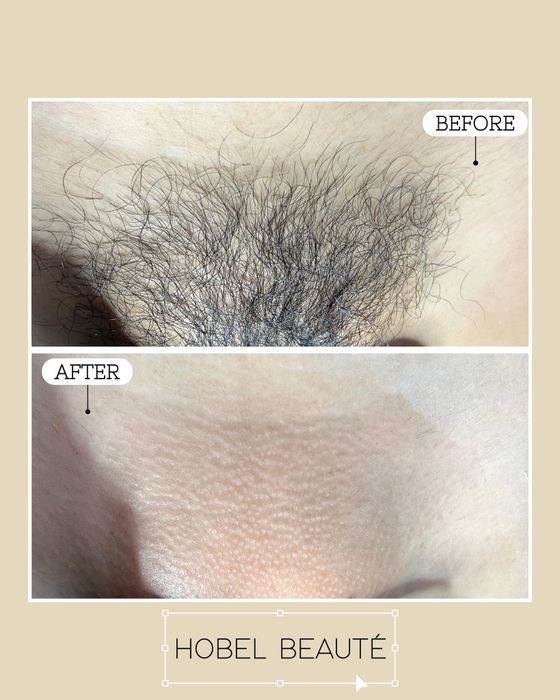 Hình ảnh HoBel Beautyroom 2