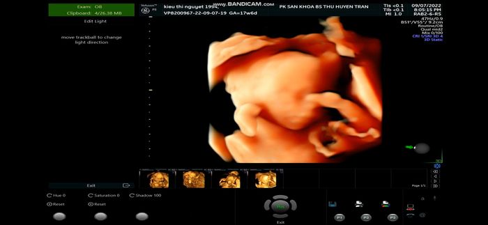 Phòng khám sản phụ khoa của ThS. Bác sĩ Thu Huyền Trần - Hình ảnh 2