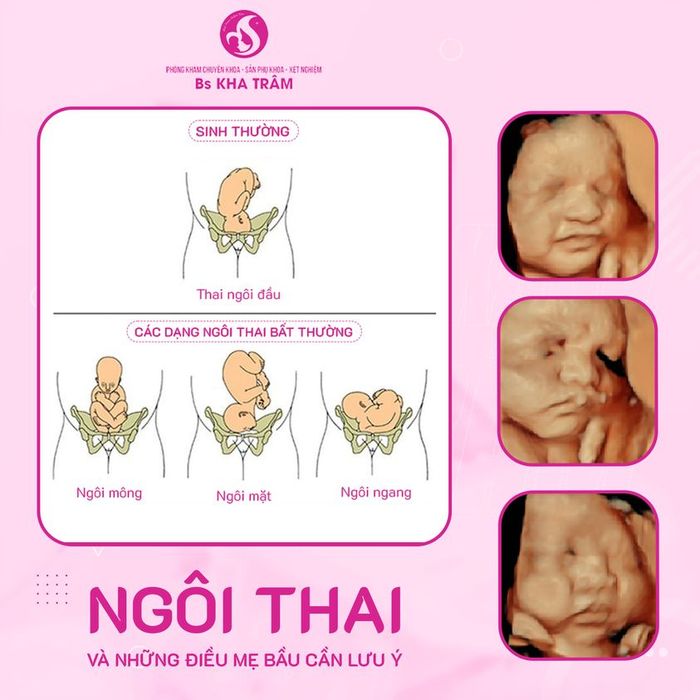 Hình ảnh phòng khám thai bác sĩ Kha Thị Trâm 3