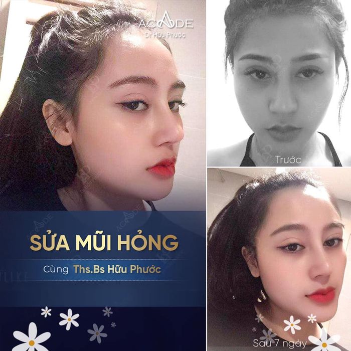 Ảnh về Phòng khám Chuyên khoa Thẩm mỹ Acade Clinic - Dr. Hữu Phước 1
