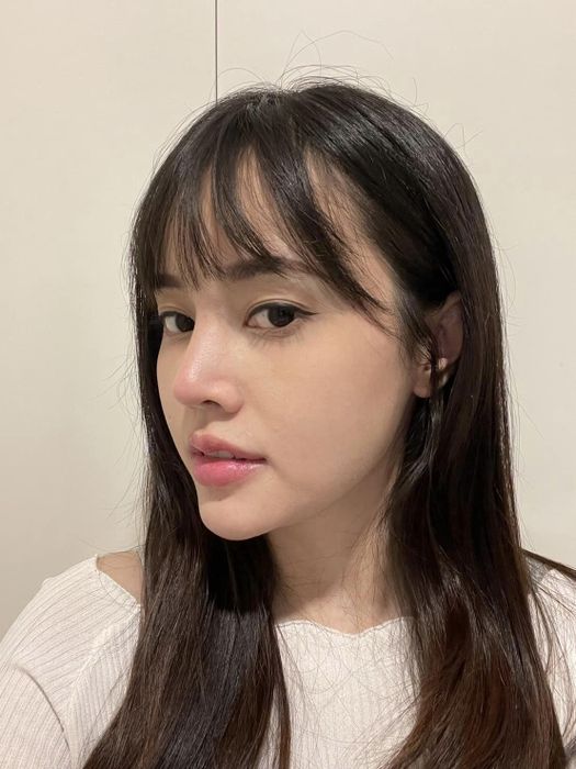 Lần thứ hai sửa mũi, cảm giác ra sao? ảnh 2