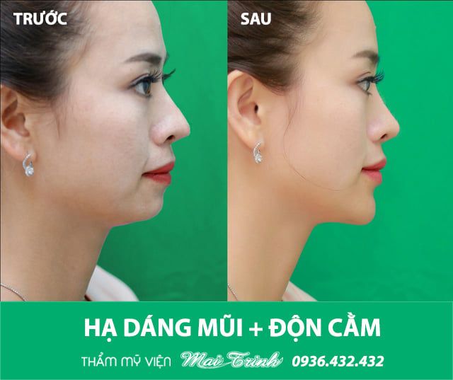 Hình ảnh Thẩm mỹ viện Mai Trinh 1