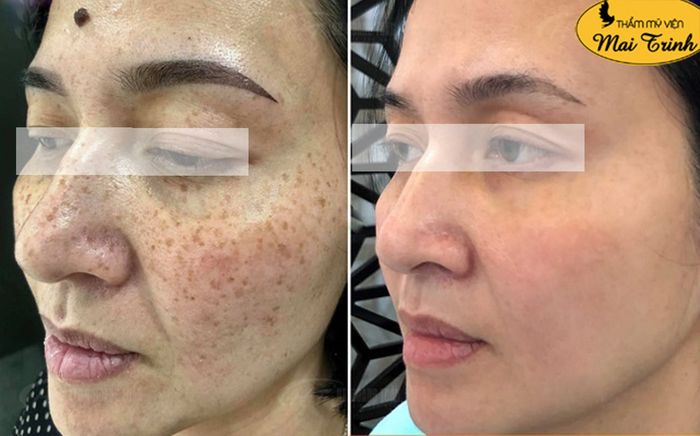 Ảnh 3 của Thẩm Mỹ Viện MAI TRINH