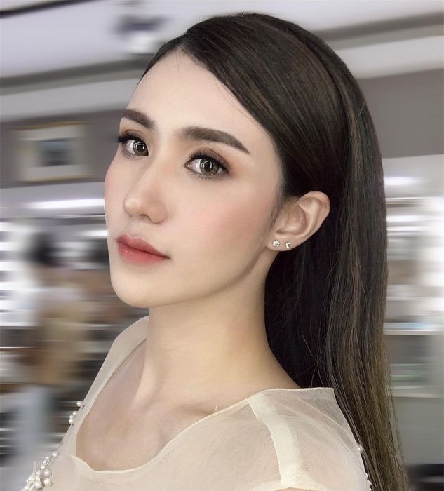 Là con gái mà có mũi gồ bẩm sinh thì phải làm gì? ảnh 1