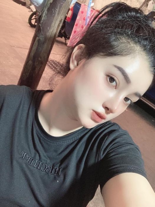 Mới nâng mũi xong, đừng vội khoe ngay và tuyệt đối đừng nghe nhận xét khi mũi còn sưng và bầm tím ảnh 1