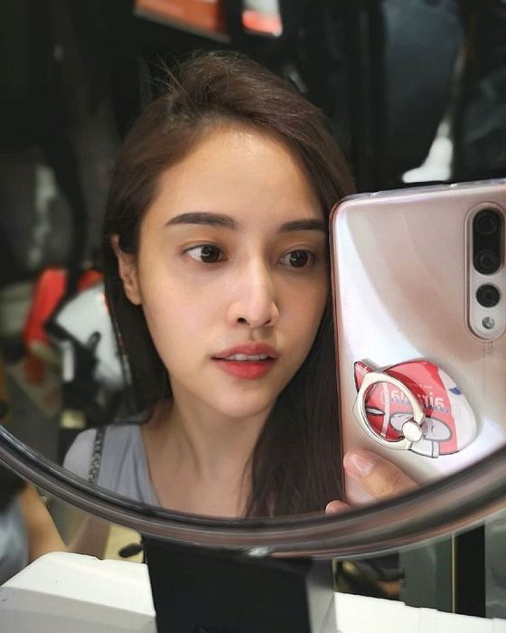 Lần thứ hai sửa mũi, cảm giác sẽ như thế nào? ảnh 1