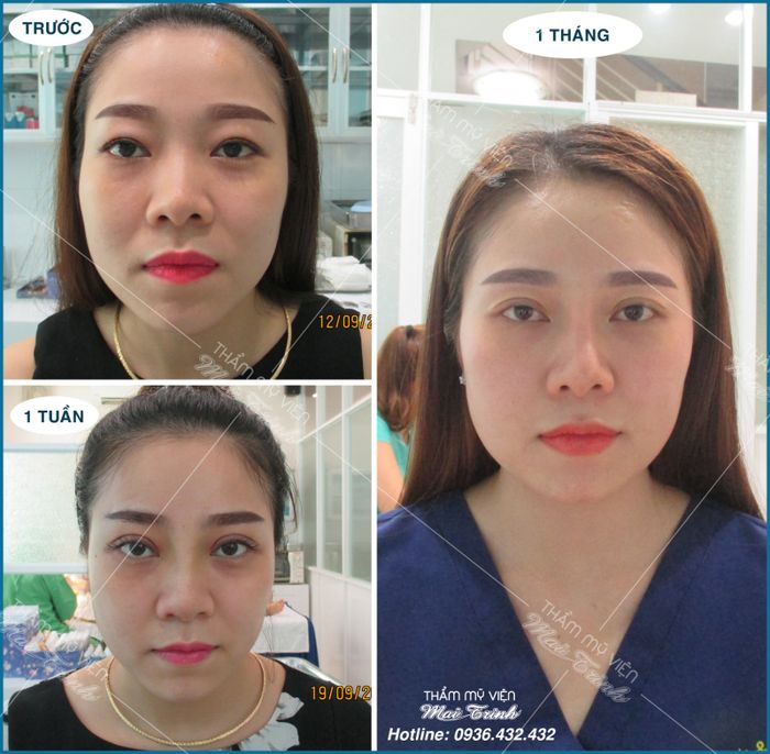 Hình ảnh Thẩm mỹ viện Mai Trinh 2