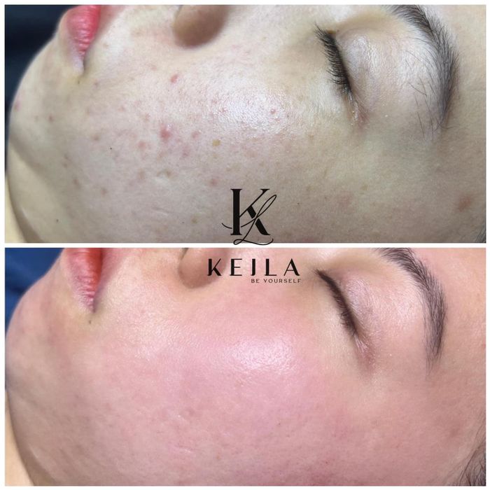 Ảnh 2 của Trân Spa
