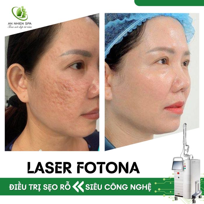 Ảnh 2 của An Nhiên Spa