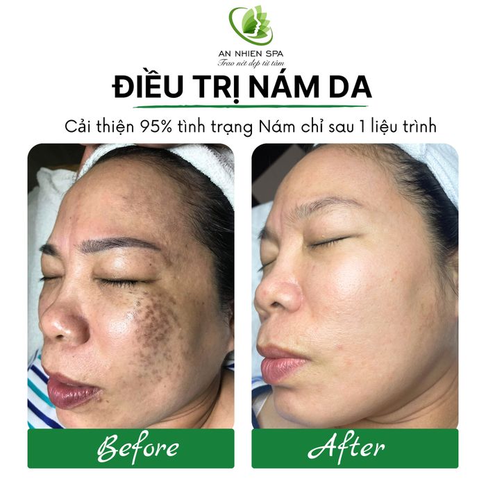 Ảnh 1 của An Nhiên Spa