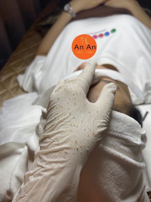 Ảnh 2 của An An Spa