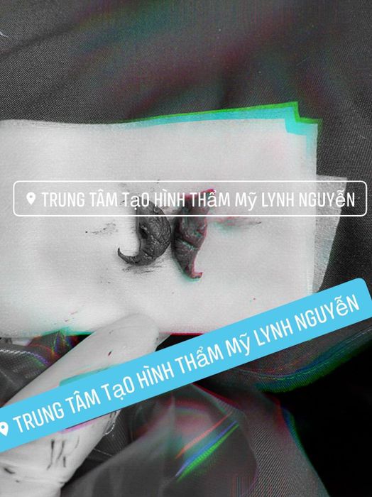 Ảnh 2 của Trung tâm Thẩm mỹ Lynh Nguyễn