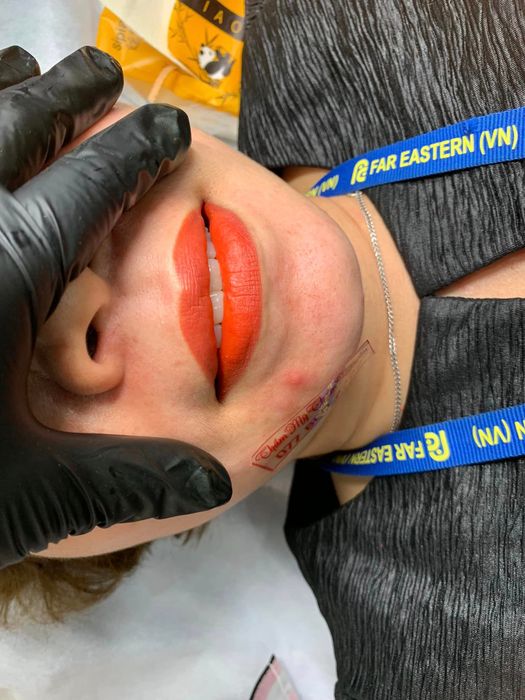 Hình ảnh Thẩm Mỹ Thấm Nguyễn 2