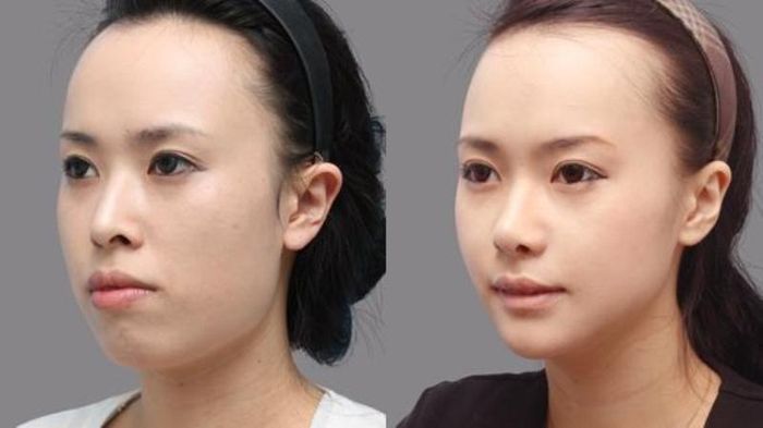 Ảnh Bệnh viện thẩm mỹ Á Âu 1