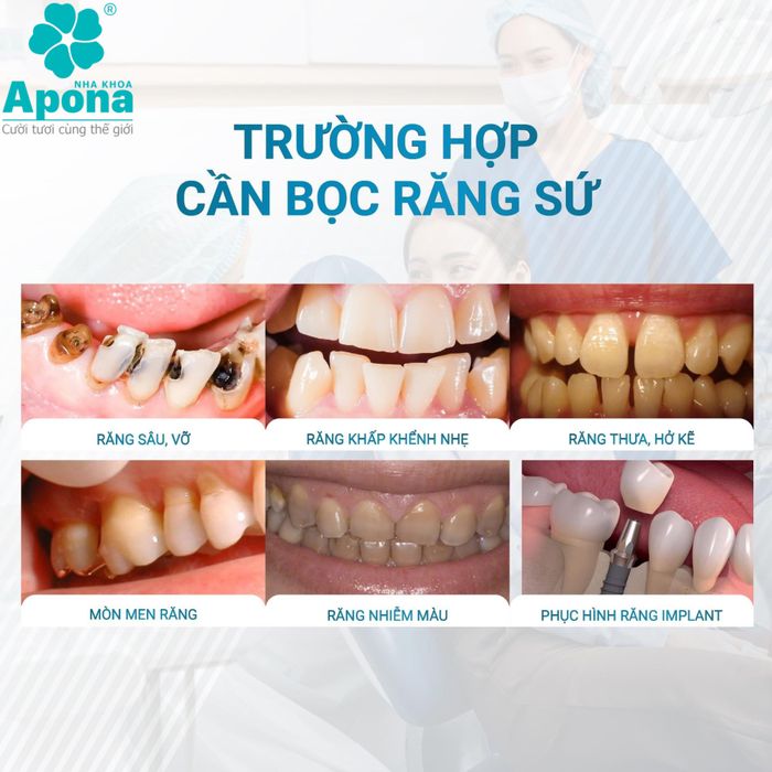 Hình ảnh 1 của Nha khoa Apona - Chuyên về răng toàn sứ thẩm mỹ & implant