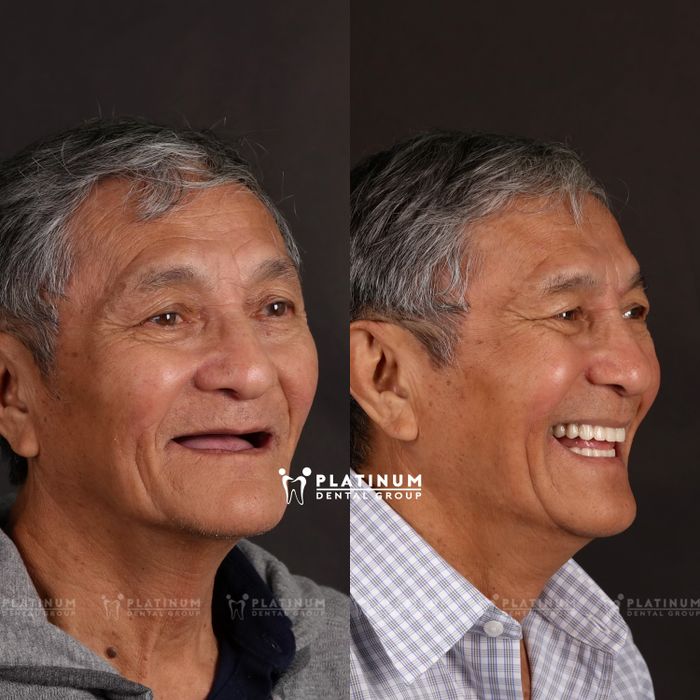 Hình ảnh 1 của Platinum Dental Group