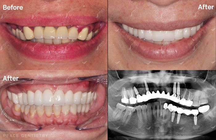 Hình ảnh 1 tại Peace Dentistry