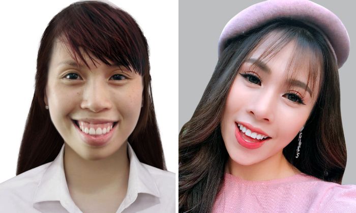 Ảnh Bệnh viện Thẩm mỹ JW