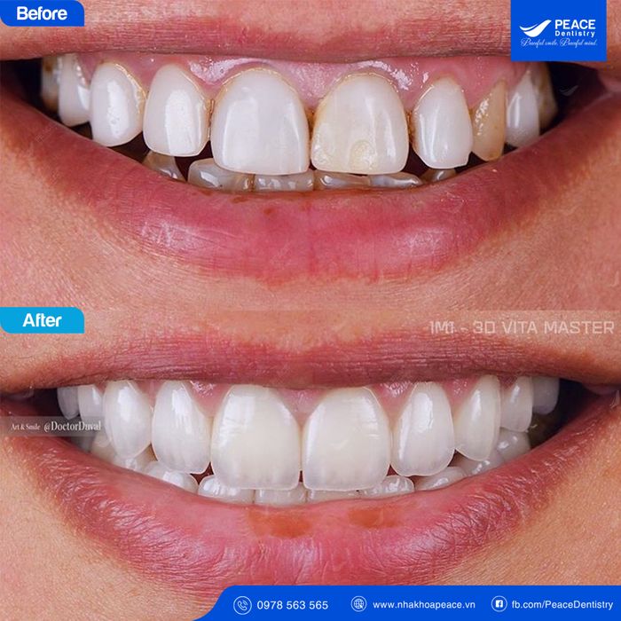 Ảnh 1 của Peace Dentistry
