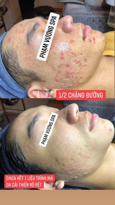 Phạm Vương (Spa) - Hình ảnh số 1