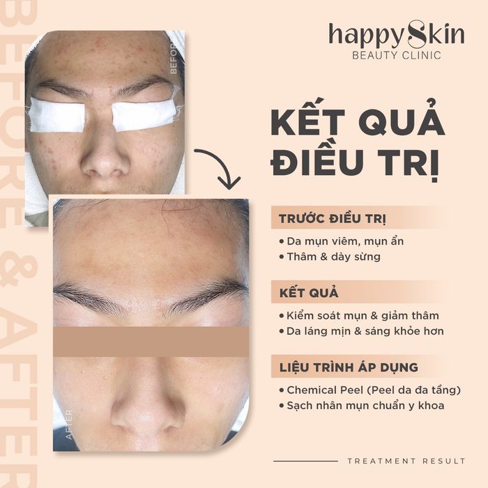 Ảnh 1 của Happy Skin Beauty Clinic