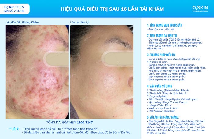 Ảnh 2 của Phòng Khám Da Liễu O2 SKIN