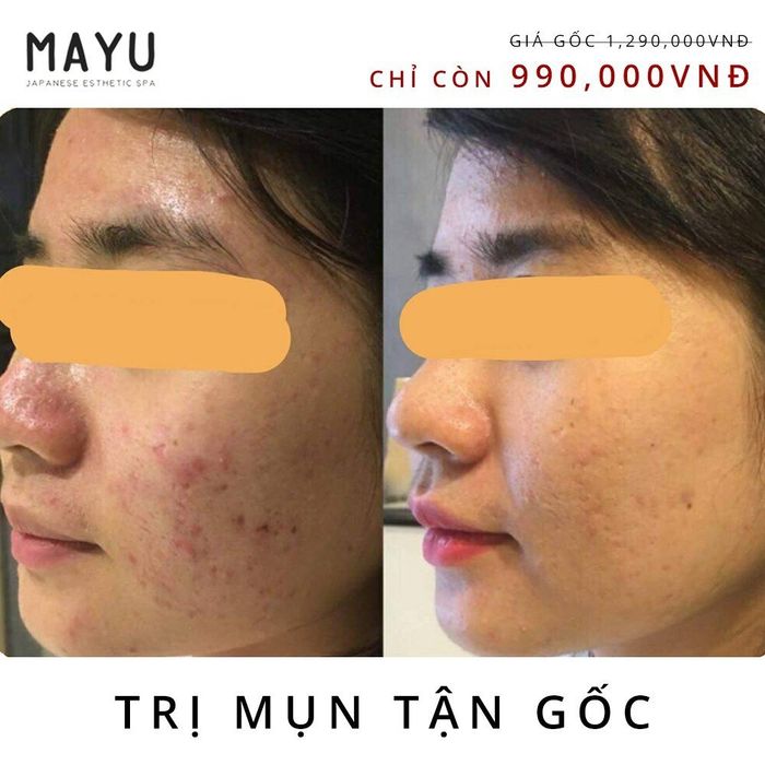 Hình ảnh 2 của Mayu Japanese Esthetic Spa